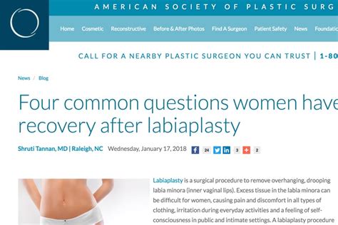 Image result for Labial Reduction Surgery
