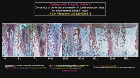 Post Extraction Recovery 的图像结果