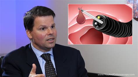 Image result for Polypectomy Recovery