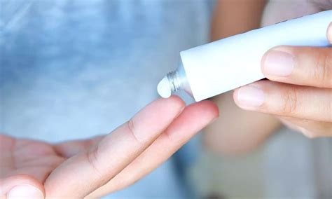 High volume of topical antifungal prescribing could lead to rise of ...