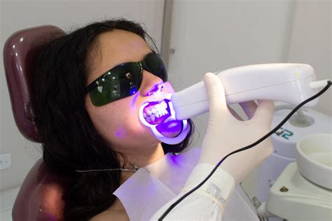 Does Vaping Stain Composite Bonding? | Tooth Club Advice