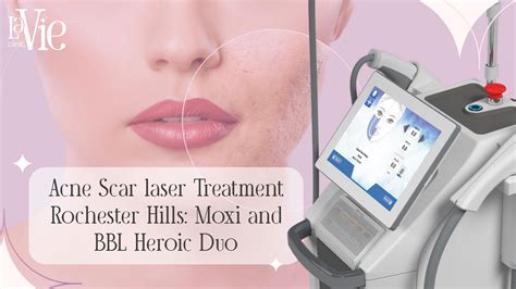 Acne Scar laser Treatment Rochester Hills | BBL | MOXI Laser