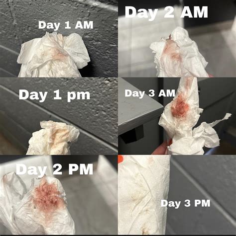 What is going on? This started 1 week before period is due. : r/menstruation