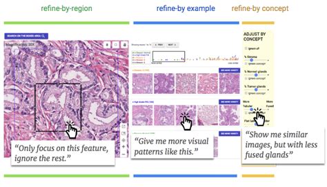 Building SMILY, a Human-Centric, Similar-Image Search Tool for Pathology