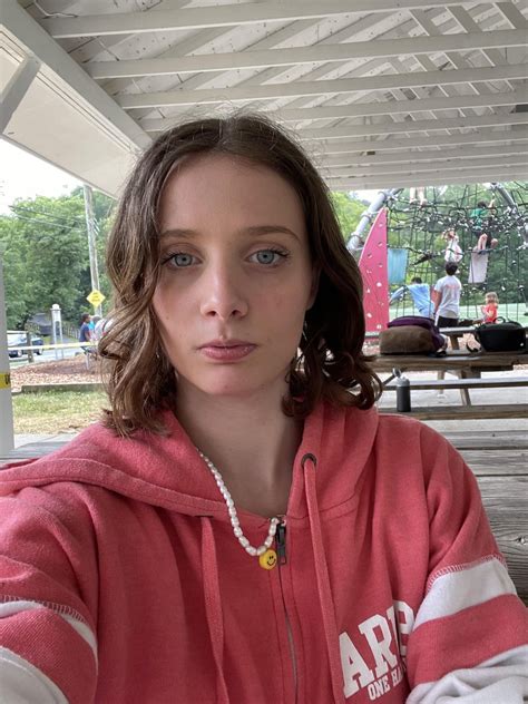 What can I do to fix my smile and facial asymmetry? : r/cosmeticsurgery