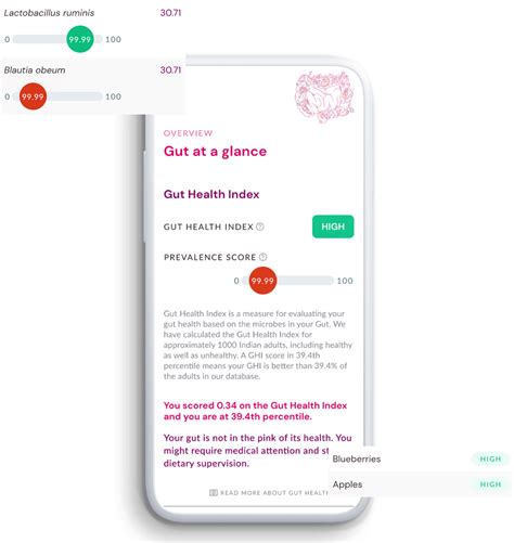 miGQ® Comprehensive Test | Microbiome Research