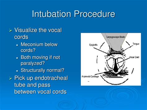Image result for Neonatal Intubation Procedure