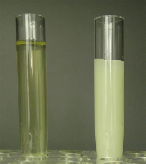 Chyluria Definition, Causes, Symptoms, Diagnosis, Diet, Treatment ...