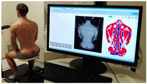 The Use of Sternum and Sacrum Angles in the Assessment of Sitting ...