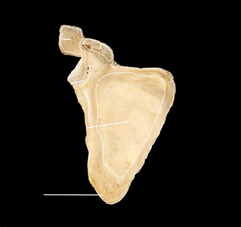 Process Bone 的图像结果