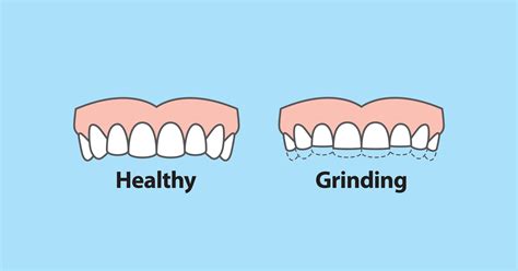 Grinds With Teeth