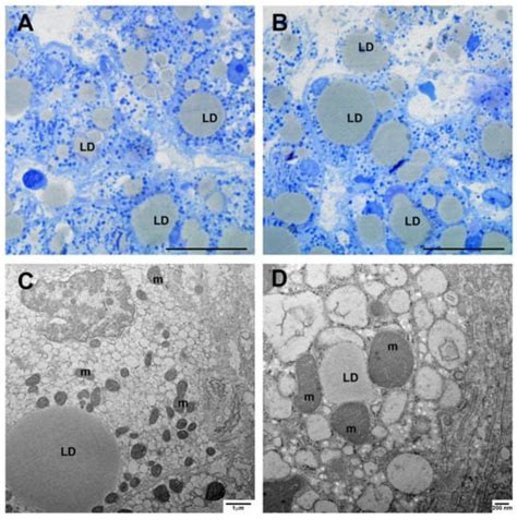 Hepatic Failure in COVID-19: Is Iron Overload the Dangerous Trigger?