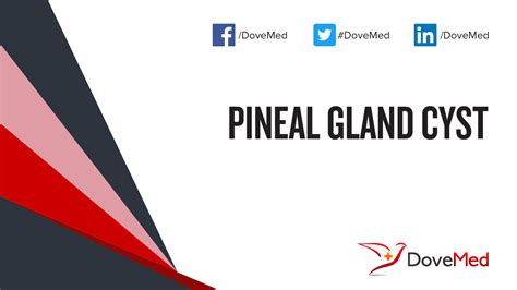 Pineal Gland Cyst