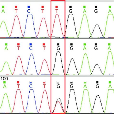 Image result for SNP Examples in Bio