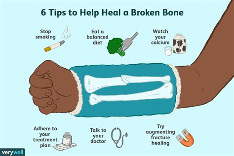 Image result for Bone Healing Process