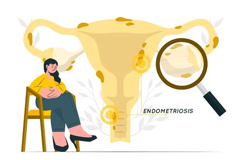 What is endometriosis and how does it affect fertility?