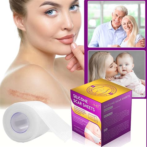 Buy Elaimei Medical Grade Silicone Scar Sheets, 1.6x 60inch Online at ...