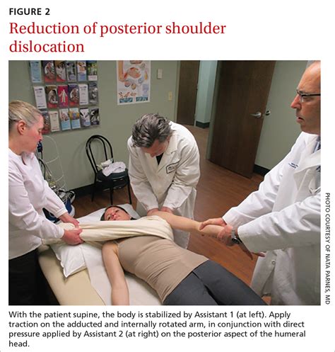 Step-by-step evaluation and treatment of shoulder dislocation | MDedge