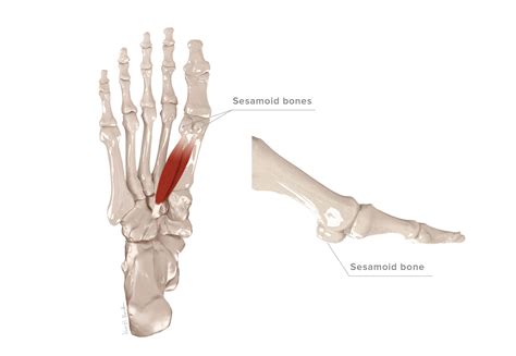 Sesamoid Fractures – KevinRoot Medical