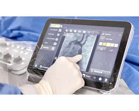 Philips Azurion 7 M20 | Image Guided Therapy System