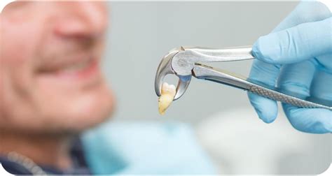 Painless Tooth Removal & Affordable Dental Extractions | Best Tooth ...