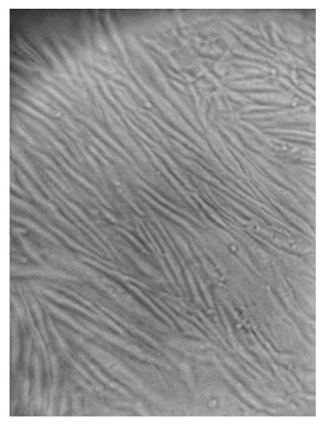 Photodynamic Therapy with Aminolevulinic Acid Enhances the Cellular ...