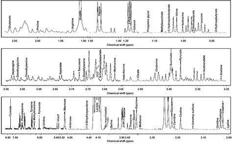 Characterization of Yak Common Biofluids Metabolome by Means of Proton ...