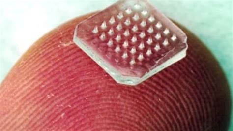 Vaccine patches may replace injections for many people before long