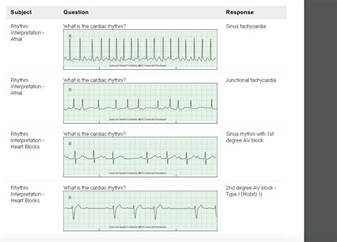 Ecg Measurements Quiz at Clemente Herrera blog