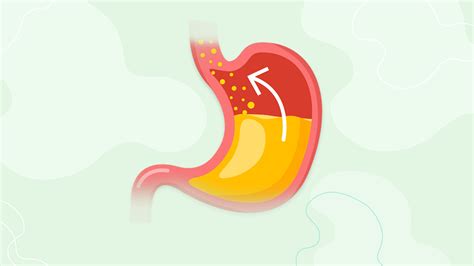 El reflujo gastroesofágico: ¿Qué es y cómo tratarlo?