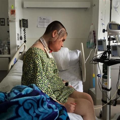 Suicide survivor gets second life with a new face. Watch viral video