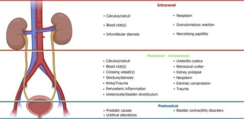 Obstructive uropathy: Overview of the pathogenesis, etiology and ...