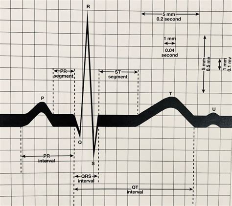 MOR Safety Services » Product categories » EKG