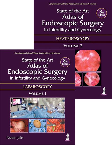 Buy State of the Art Atlas of Endoscopic Surgery in Infertility and ...