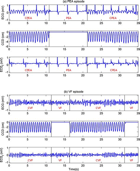 An automatic system for the comprehensive retrospective analysis of ...