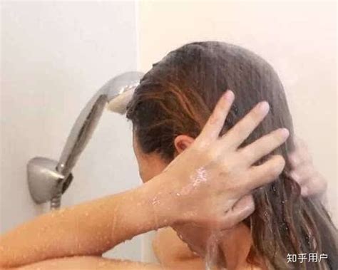 每天洗头都掉很多头发怎么办？ - 知乎