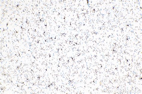 IBA1 antibody (81728-1-RR) | Proteintech