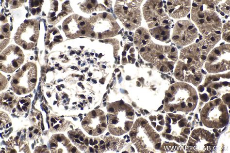 GTF2E1 antibody (24405-1-AP) | Proteintech