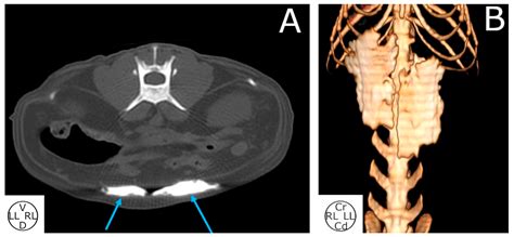 Description and Evaluation of Dye and Contrast Media Distribution of ...