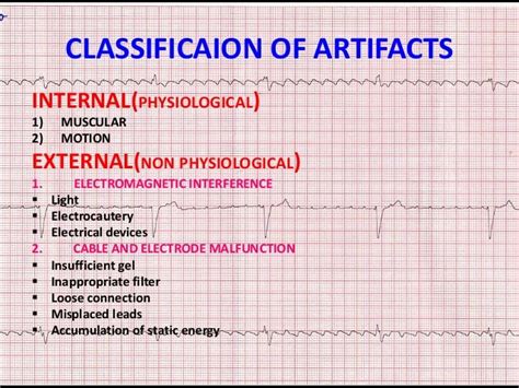 ECG ARTIFACTS AND PITFALLS