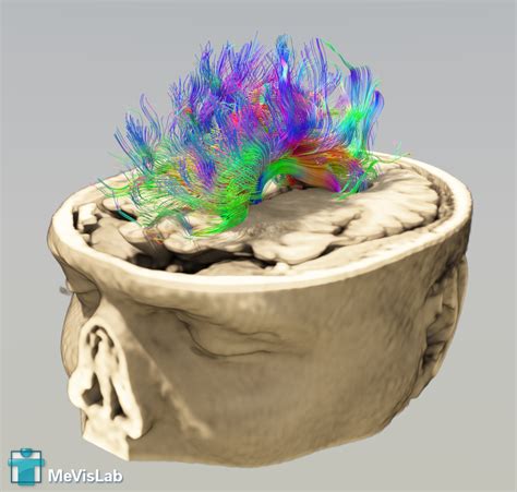 Image result for MeVisLab Connectors Triangle