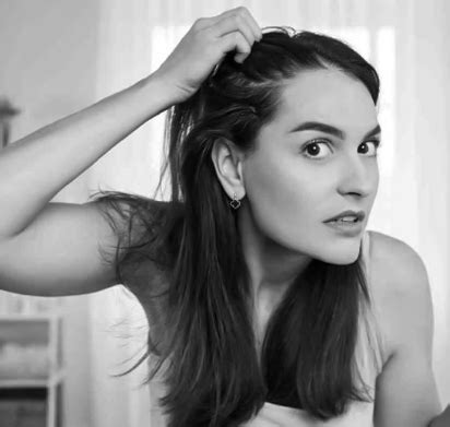 Hair Loss in Women Treatment in Delhi | DermaClinix