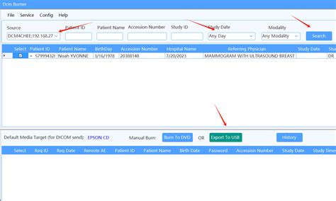 DICOM Query Retrieve Tool 的图像结果