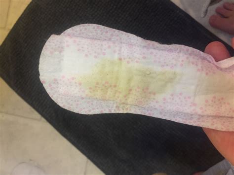 What Is Yellow Discharge Postpartum at Harold Case blog