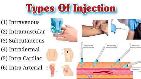 Image result for All Types of Injection