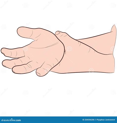 Image Graphics Vector Outline Wrist Pain is Often Caused by Sprains or Fractures from Sudden ...