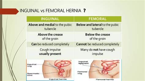 HERNIA PDF.pdf