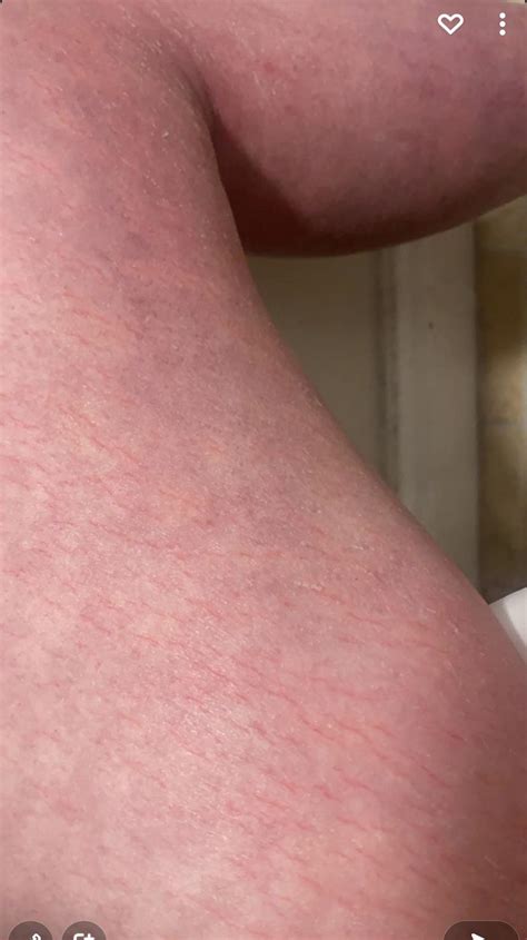 Image result for Splitting Me Open