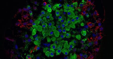 Lab notes: Injectable gel can deliver insulin-producing islet cells to ...