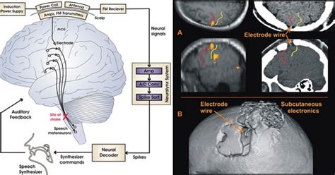 Wireless Brain Computer Interface 的图像结果